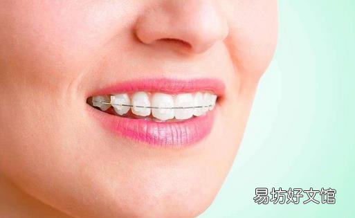 隐形牙套要带多久