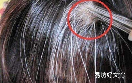 少年出现白头发的主要原因 改善少年白的中医技巧