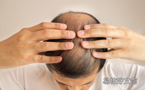 头发少学会科学地保养头发 预防脱发的秘诀