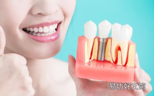 种一口牙相当于买辆宝马 种植牙的有关护理事项