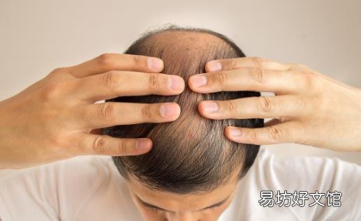 改善脱发是场持久战 解决长期脱发问题有妙招