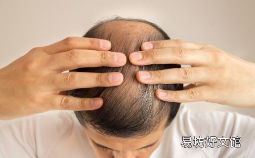 头发少要怎么保养 预防脱发十秘诀