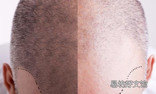 头发少要怎么保养 预防脱发十秘诀
