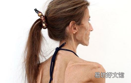 女人太骨感要警惕10恶疾