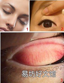 眼睛里进东西怎么办？眼睛进异物怎么办