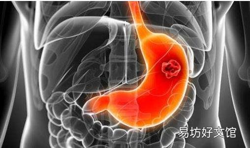 胃病三分治七分养 能养胃助消化的食物