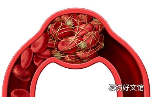 预防血栓平时多吃黑色食物 晚睡前喝杯开水预防血栓