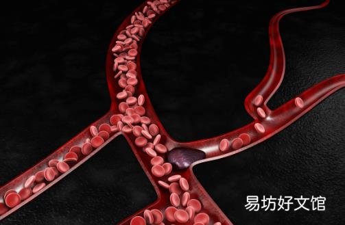 预防血栓平时多吃黑色食物 晚睡前喝杯开水预防血栓