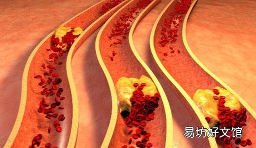 八种蔬菜帮你通血管垃圾 预防血管堵塞的方法