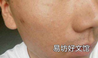 痘印怎么修复 痘印怎么修复正常皮肤