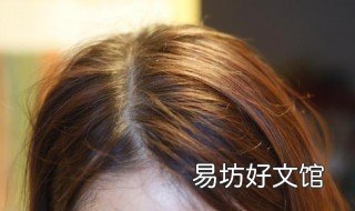 春季头皮屑多是什么原因 春季头皮屑多是什么原因导致的