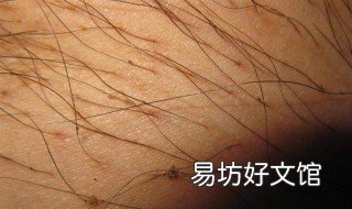 阴虱哪来的 阴虱是哪里来的
