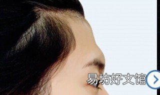 额头被撞凹进去了怎么办 额头被撞凹进去了图片
