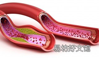 额头血管突出能用什么方法治疗 额头上有突出的血管