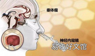acth垂体瘤是恶性的吗