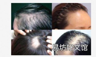 4个靠谱的防脱发方法 防脱发有什么方法