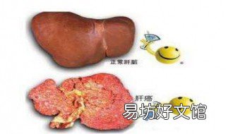 肝癌早期九大征兆 肝癌早期的五大征兆