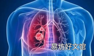 肺炎会传染吗,要注意吃什么好? 肺炎要传染吗?