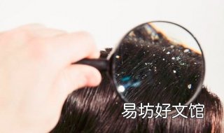 头痒怎么办 有头皮屑头痒怎么办