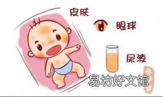 婴儿黄疸怎么办 婴儿黄疸怎么办治疗