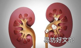 肾结石不能吃什么 肾结石不能吃什么钙片