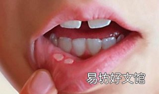 小孩长口疮怎么办 小孩长口疮怎么治