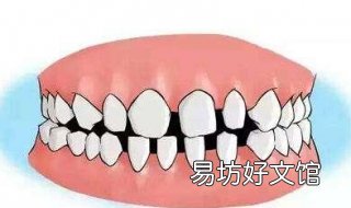 牙齿缝隙大怎么办 五岁小孩牙齿缝隙大怎么办