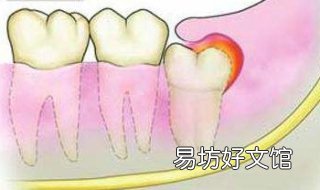 牙龈肿痛怎么办 牙龈肿痛怎么办一招教你3秒治牙疼