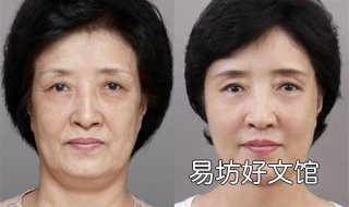 皮肤松弛了怎么办 生完孩子皮肤松弛了怎么办