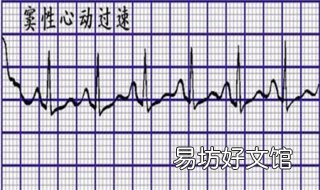 窦性心动过速怎么办 孕37周窦性心动过速怎么办