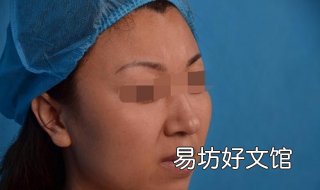 光子嫩肤后的注意事项 光子嫩肤的注意事项有哪些