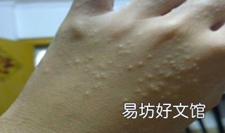 真菌感染怎么办 脚底真菌感染怎么办
