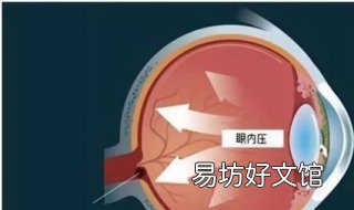 眼压高怎么办 儿童眼压高怎么办