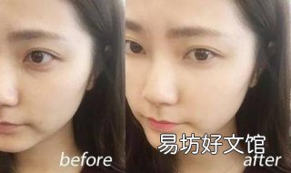 眼部细纹怎么办 眼部有细纹怎么办?
