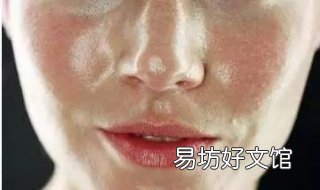 皮肤出油怎么办 皮肤出油怎么办 女性