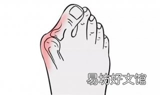 大脚骨该怎么办 大脚骨该咋办
