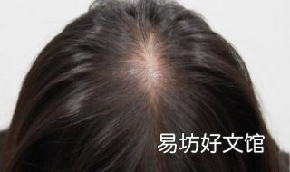 头发少怎么办 新生儿头发少怎么办