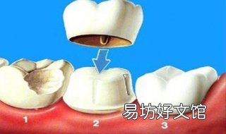 牙齿缺损怎么办 牙齿牙龈处缺损怎么处理