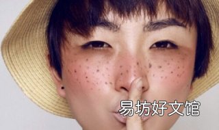 季节皮肤过敏怎么办 季节皮肤过敏怎么办小妙招