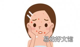 一脸痘印怎么办 一脸痘印怎么办小妙招
