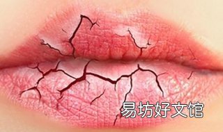 嘴唇干裂怎么办 孕妇嘴唇干裂怎么办