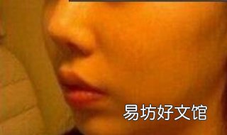 朝天鼻怎么办 小孩朝天鼻怎么办