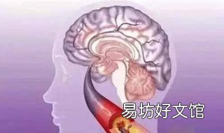 得了脑血栓怎么办 得了脑血栓应该怎么办