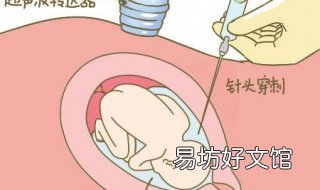 羊水穿刺注意事项 做羊水穿刺的注意事项