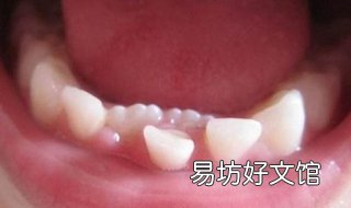 乳牙滞留怎么办 乳牙滞留的原因及解决方法