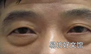 眼部皮肤松弛怎么办 眼部皮肤松弛怎么回事