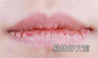 嘴唇干裂起皮怎么办 三岁儿童嘴唇干裂起皮怎么办