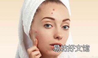脸上长粉刺怎么办 脸上长粉刺怎么办用什么方法消除