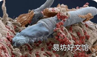 尘螨过敏怎么办 粉螨尘螨过敏怎么办