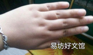 手胖怎么办 手掌胖怎么办